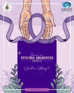 Vitiligo is more than skin deep.
It’s a condition that affects pigmentation—but also impacts confidence and perception.
This month, we stand for awareness, acceptance, and inclusivity. 🤍
#VitiligoAwareness #InclusiveBeauty #SkinDiversity #ConfidenceInYourSkin #Dermatology
