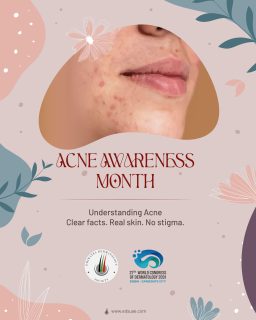 Acne is one of the most common skin conditions—yet it’s often misunderstood.
This Acne Awareness Month, we’re breaking down the facts, causes, and care strategies to help you better understand your skin.
Because informed skin is empowered skin.
#AcneAwarenessMonth #SkinHealth #Dermatology #SkincareEducation #HealthySkin