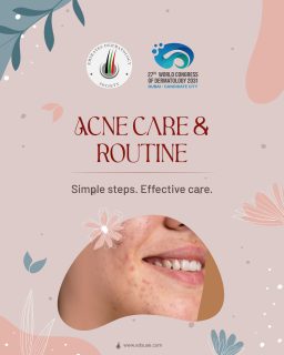 Managing acne doesn’t have to be complicated.
A gentle routine, the right ingredients, and consistency can make all the difference. Your skin needs care—not harsh treatment.
Stick to the basics. Trust the process.
#AcneAwarenessMonth #SkinHealth #Dermatology #SkincareEducation #HealthySkin