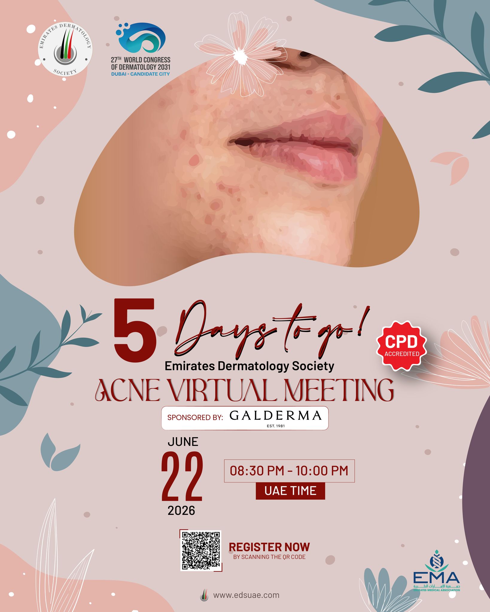 📅 Only 5 Days Left!

Don't miss our upcoming Acne Virtual Meeting, where leading experts will share valuable insights into acne diagnosis, treatment, and patient care.
We're looking forward to seeing you there!

#AcneVirtualMeeting #Dermatology #SkinHealth #MedicalEducation #HealthcareProfessionals #AcneCare