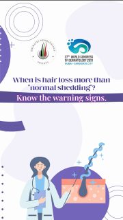 🍃 Not all hair loss is the same.
It’s normal to lose some hair every day—but when hair loss becomes persistent, sudden, or is accompanied by scalp changes, it’s time to seek professional advice.
Knowing when to consult a dermatologist can help identify the cause early and improve treatment outcomes.

🎥 Watch this reel to learn the signs you shouldn’t ignore.

Healthy hair starts with awareness, and early action can make all the difference.


#HairLossAwarenessMonth #HairCare #HairHealth #ScalpHealth #SeeADermatologist Dermatology EmiratesDermatologySociety EDS