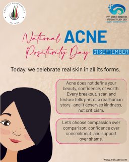 ACNE DOESN’T DEFINE YOU. 💕
Your skin can have breakouts and still be beautiful.
You can choose treatment without feeling ashamed.
You can love yourself while working toward healthier skin.
Real skin. Real people. Real confidence.
#AcnePositivityDay #AcnePositivity #RealSkin #LoveYourSkin #SkinConfidence