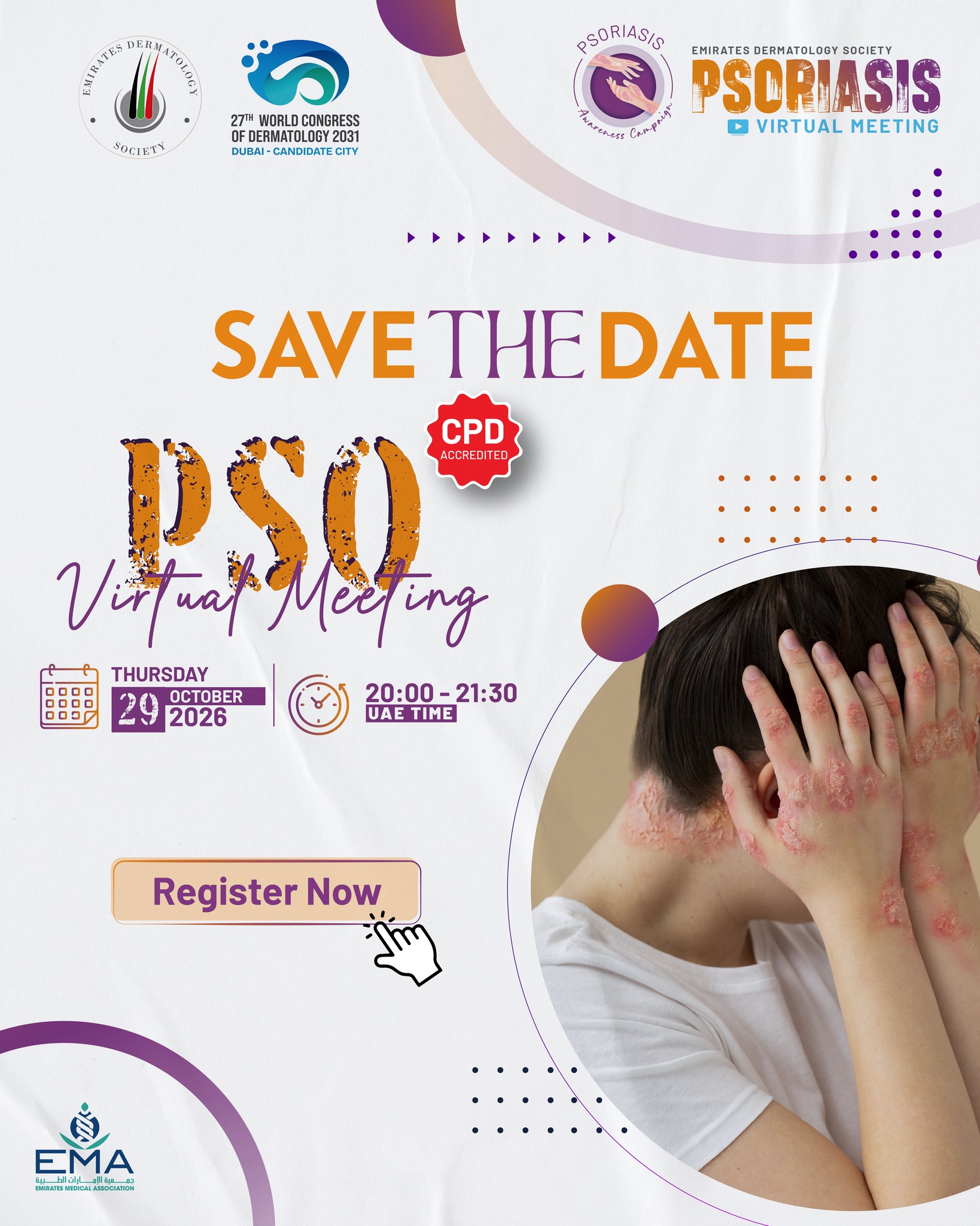 Save the Date: Psoriasis Virtual Meeting

Join the Emirates Dermatology Society for an accredited virtual meeting dedicated to psoriasis awareness, knowledge sharing, and clinical learning.

🗓 Thursday, 29 October 2026
🕗 20:00–21:30 UAE Time
💻 Online | CPD Accredited
 
Connect with peers and stay informed on advances in psoriasis care.

#Psoriasis #PsoriasisAwareness #EDSPsoriasis #EmiratesDermatologySociety #Dermatology #MedicalEducation #CPD #VirtualMeeting #UAE