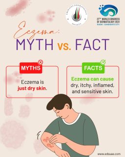 Eczema is more than dry skin. For many people, it can mean persistent itch, discomfort, irritated skin, disrupted sleep, and emotional stress.
A little awareness can make daily life feel less isolating.
#EczemaFacts #AtopicDermatitis #EczemaAwareness #ChronicConditionSupport