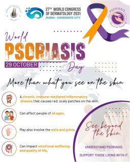 🌍 World Psoriasis Day | 29 October
Psoriasis is more than what you see on the skin. 💙

Psoriasis is a chronic, immune-mediated inflammatory disease that can cause red, scaly patches on the skin. It may also affect the nails and joints and can have a significant impact on quality of life and emotional wellbeing.

This World Psoriasis Day, the Emirates Dermatology Society joins the global dermatology community to raise awareness, promote understanding, and support those living with psoriasis.

✨ See beyond the skin. Understand psoriasis. Support those living with it.

#WorldPsoriasisDay #Psoriasis #PsoriasisAwareness #PsO #Dermatology #SkinHealth #EmiratesDermatologySociety #EDS #PsoriasisCare