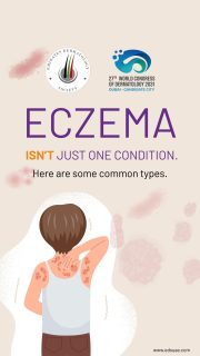Eczema is an umbrella term for several conditions that can cause itchy, dry, inflamed, or irritated skin. Because symptoms and treatment needs can vary, getting an accurate diagnosis matters.

This reel highlights only a few common types of eczema. A dermatologist can help identify what is affecting your skin and develop a care plan that fits your needs. 💙


#EczemaAwarenessMonth #TypesOfEczema #AtopicDermatitis #ContactDermatitis #HandEczema SkinHealth Dermatology